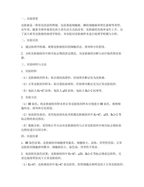 皮肤癌实验报告