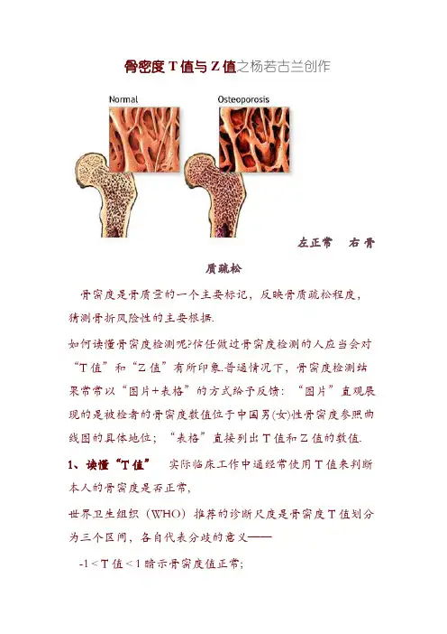BMD-9超声骨密度参数及报告单说明