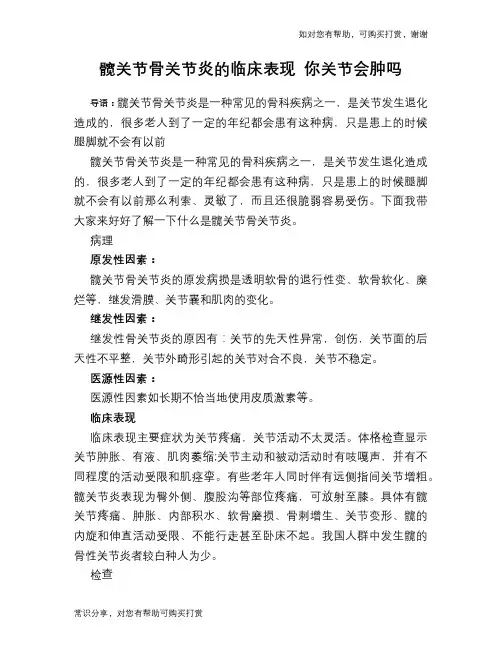 髋关节骨关节炎的临床表现 你关节会肿吗