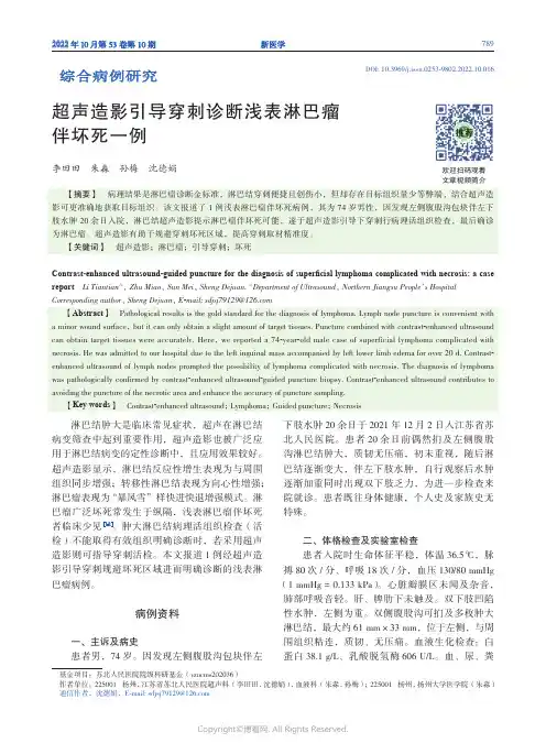 超声造影引导穿刺诊断浅表淋巴瘤伴坏死一例