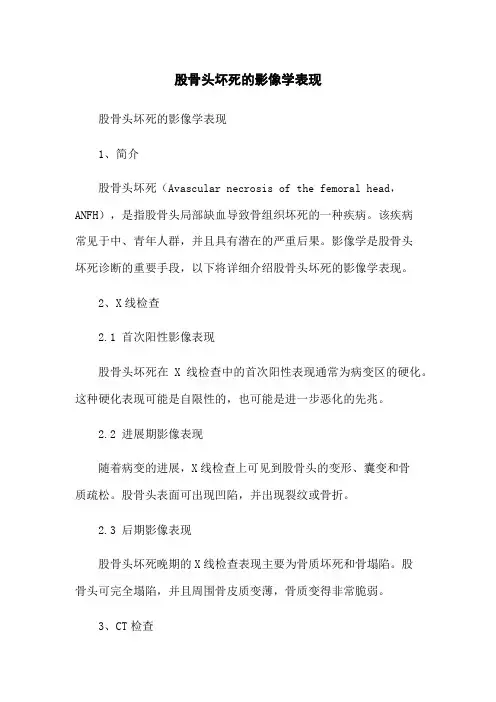 股骨头坏死的影像学表现