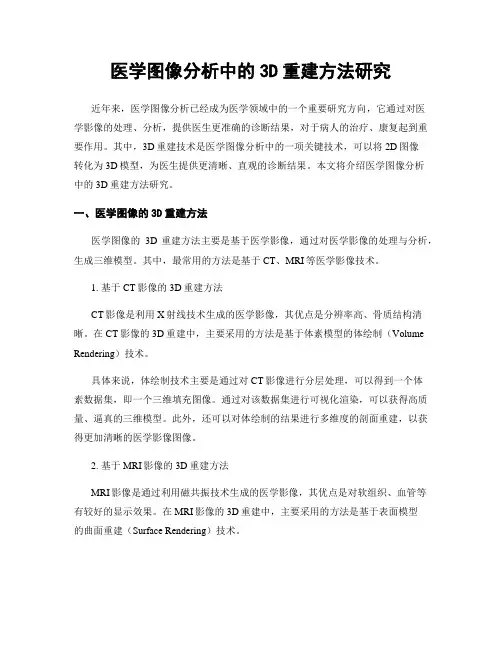 医学图像分析中的3D重建方法研究