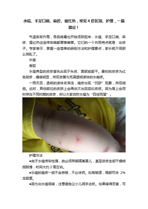 水痘、手足口病、麻疹、猩红热，常见4疹区别、护理，一篇搞定！
