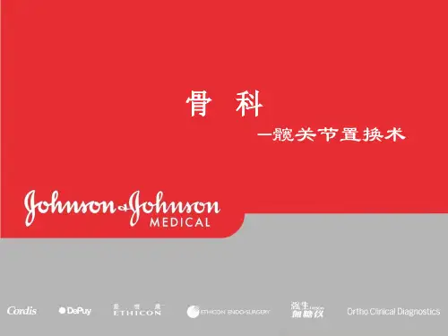 髋关节置换术
