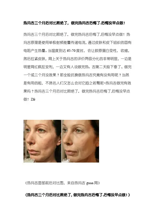 热玛吉三个月后对比照绝了,做完热玛吉后悔了,后悔没早点做!