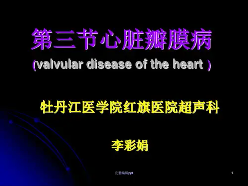 风湿性二尖瓣狭窄--李ppt课件