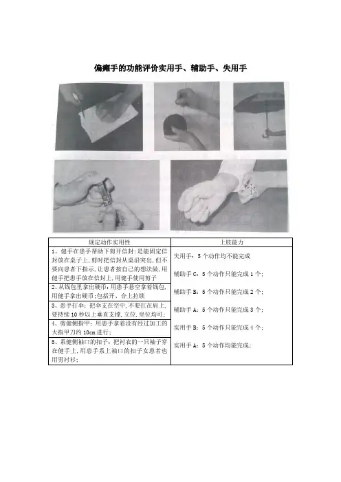 偏瘫手的功能评价实用手辅助手失用手
