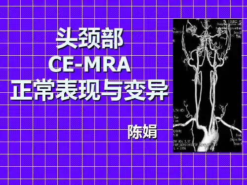 头颈血管正常与变异课件