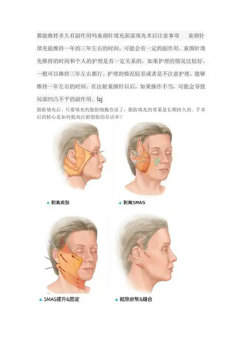 都能维持多久有副作用吗童颜针填充面部填充术后注意事项