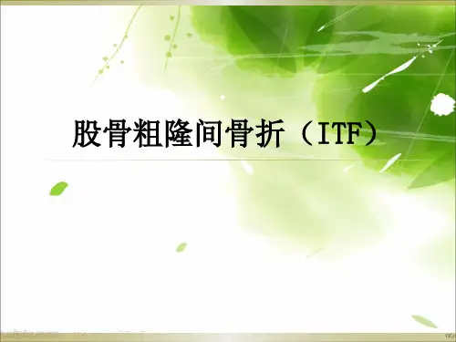 股骨粗隆间骨折(ITF)