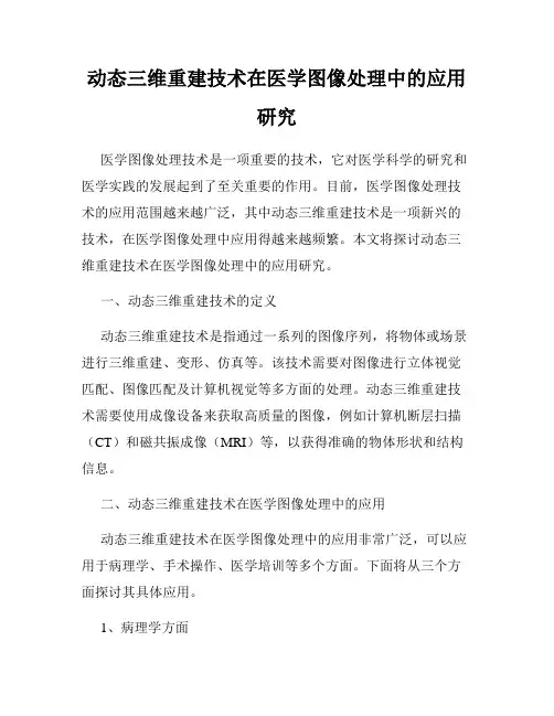动态三维重建技术在医学图像处理中的应用研究