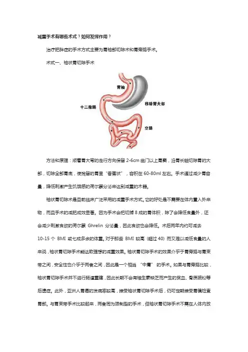 减重手术概述