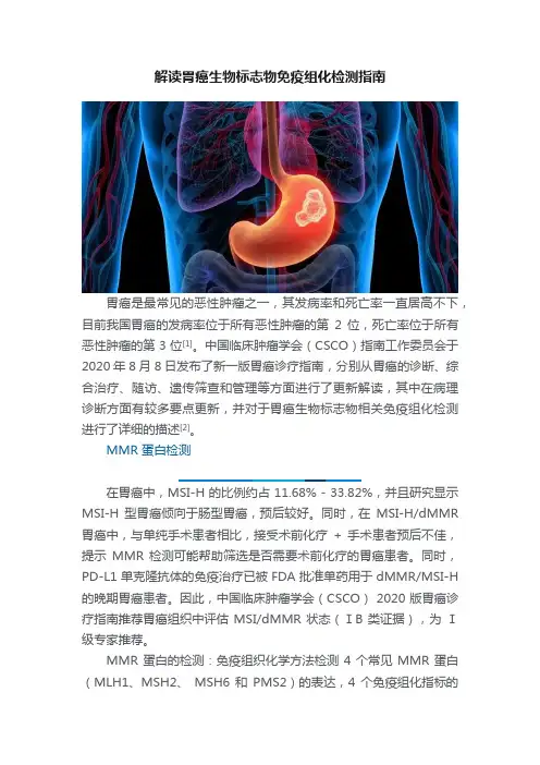 解读胃癌生物标志物免疫组化检测指南