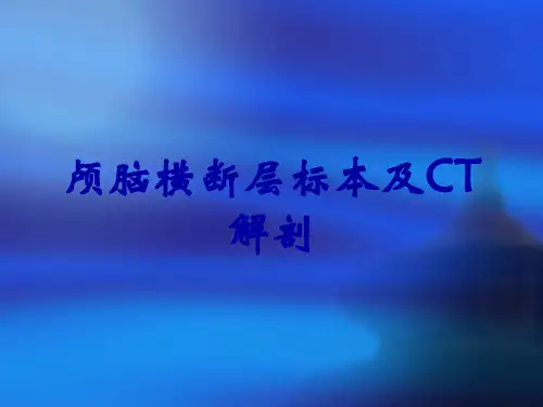 颅脑横断层标本及CT解剖