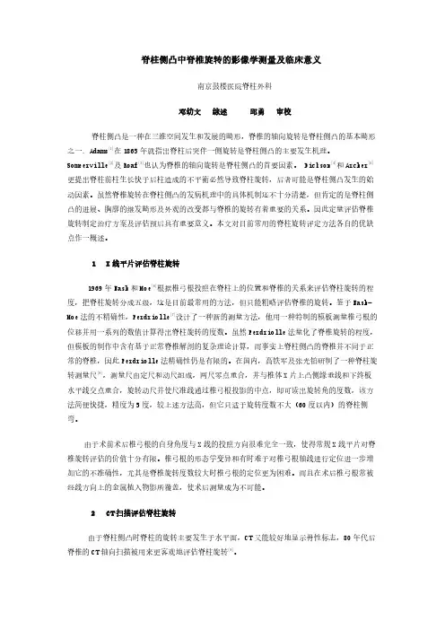 脊柱侧凸中脊椎旋转的影像学测量及临床意义