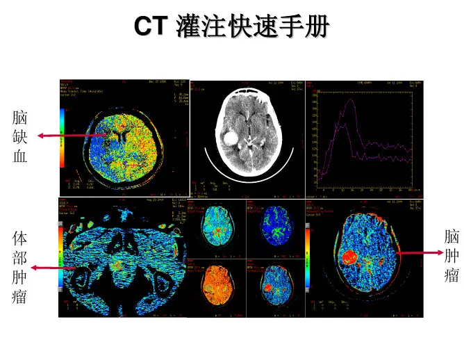 CT灌注快速操作手册