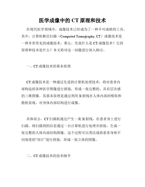医学成像中的CT原理和技术