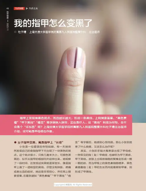 我的指甲怎么变黑了