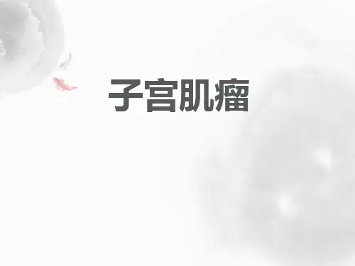 子宫肌瘤  ppt课件