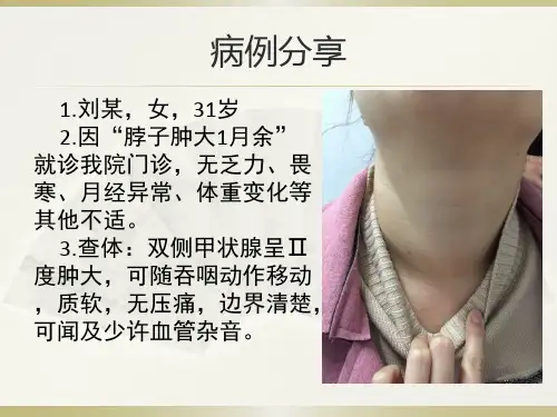甲状腺功能减退症病例分享ppt课件