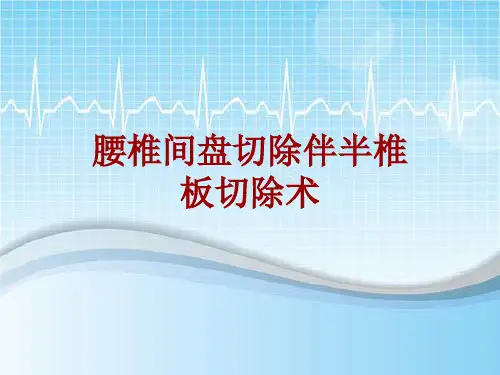 手术讲解模板：腰椎间盘切除伴半椎板切除术