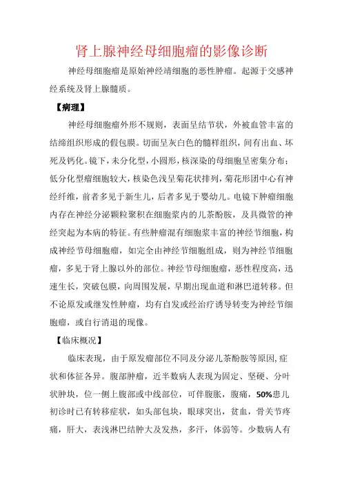 肾上腺神经母细胞瘤的影像诊断