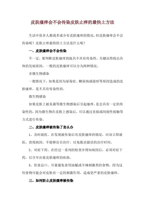 皮肤瘙痒会不会传染 皮肤止痒的最快土方法