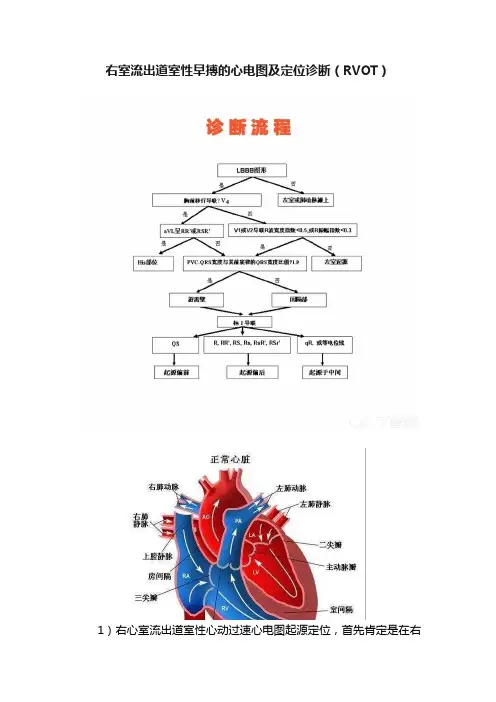 右室流出道室性早搏的心电图及定位诊断（RVOT）