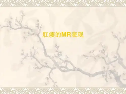 肛瘘的MR表现ppt课件