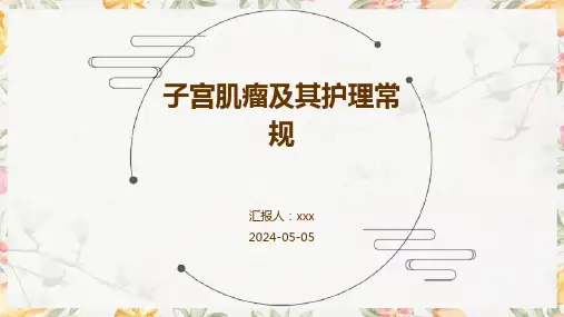 子宫肌瘤及其护理常规PPT课件