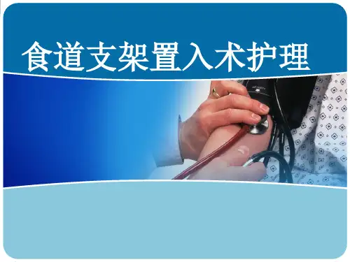 食管支架