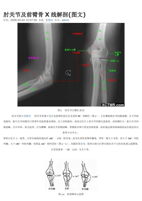 骨科X线解剖(四肢、关节)讲解