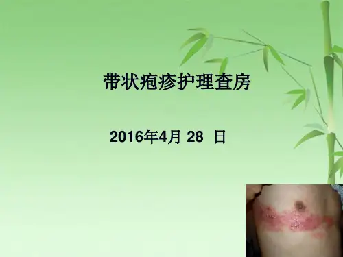 带状疱疹查房(共34张PPT)