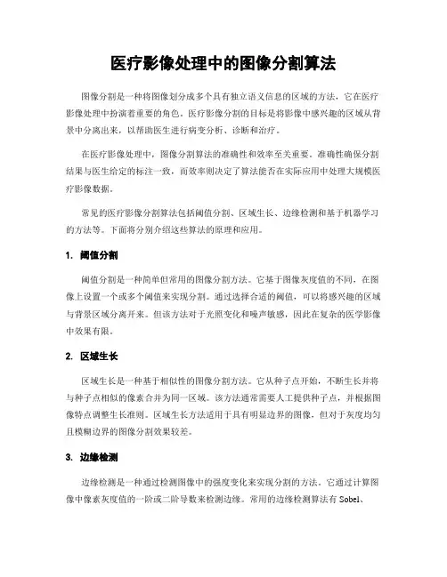 医疗影像处理中的图像分割算法
