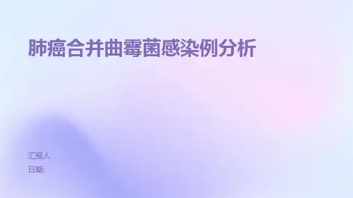 肺癌合并曲霉菌感染例分析