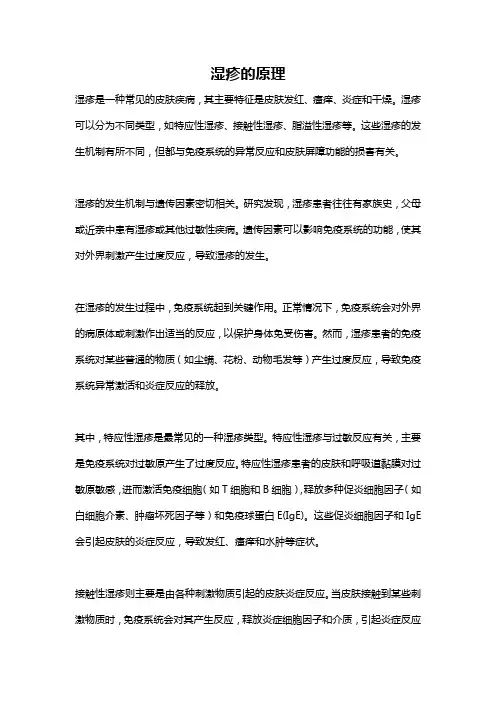 湿疹的原理