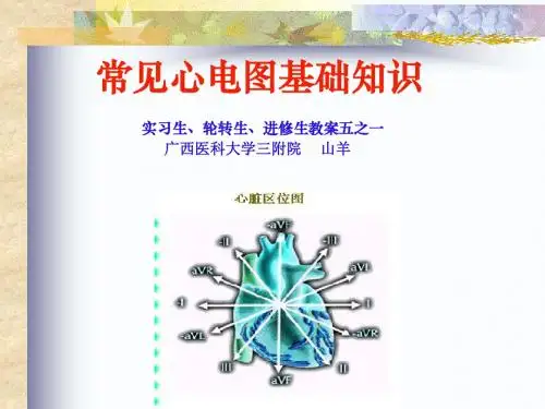心电图教案一