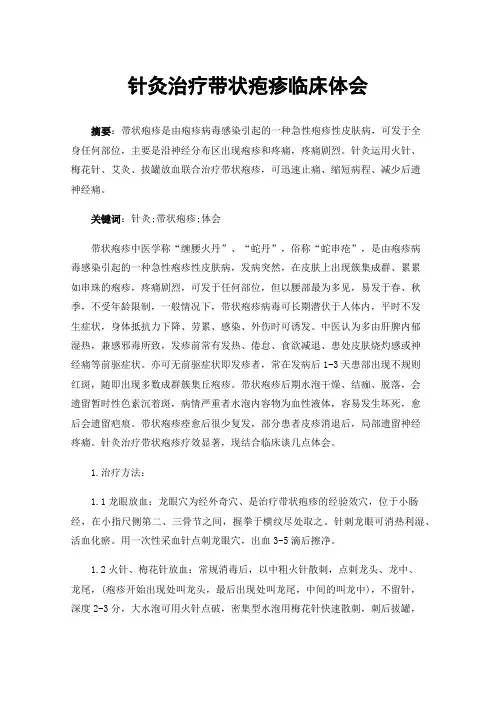 针灸治疗带状疱疹临床体会