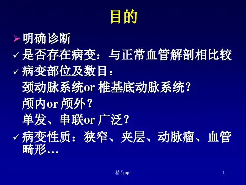 脑血管造影流程PPT课件