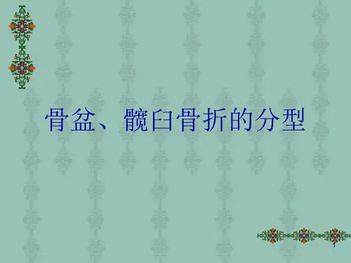 骨盆髋臼骨折的分型(课堂PPT)