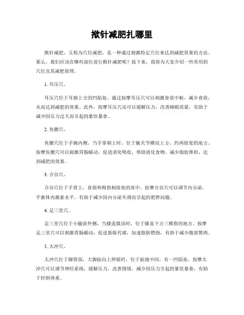 揿针减肥扎哪里