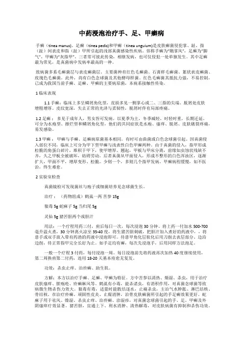 中药浸泡治疗手、足、甲癣病