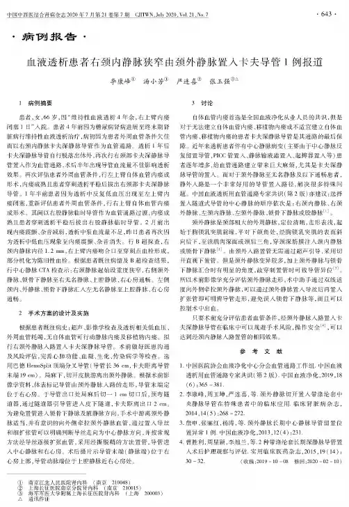 血液透析患者右颈内静脉狭窄由颈外静脉置入卡夫导管1例报道
