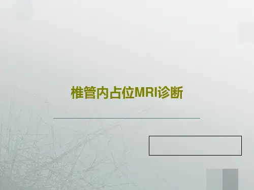 椎管内占位MRI诊断46页PPT