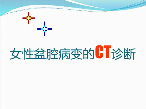 女性盆腔病变的CT诊断