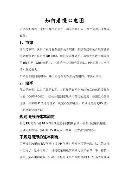 如何看懂心电图解读