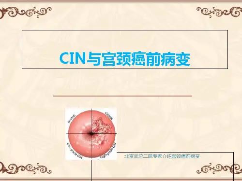 CIN与宫颈癌前病变_图文