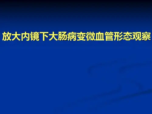 放大内镜对大肠病变微血管形态观察