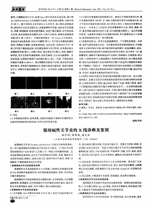 银屑病性关节炎的x线诊断及鉴别