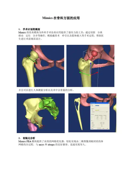 Mimics在骨科方面的应用